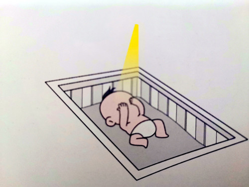 Figure 3 Direct exposure to strong light will affect the baby's vision health